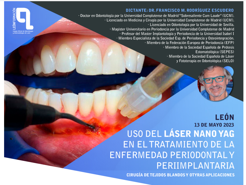 Uso del láser Nano-Yag en enfermedad periodontal y periimplantaria
